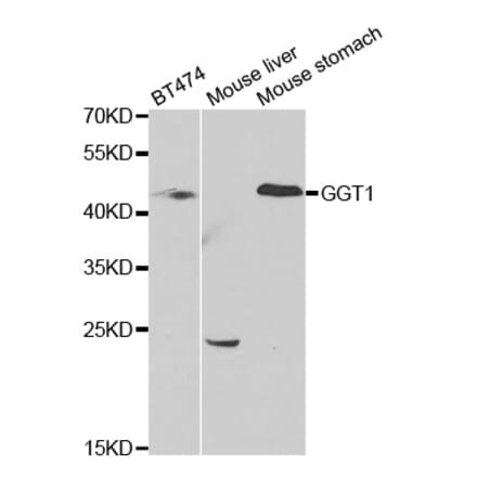 Western blot - GGT1 Antibody from Signalway Antibody (32429) - Antibodies.com