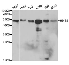 Western blot - HMBS Antibody from Signalway Antibody (32430) - Antibodies.com