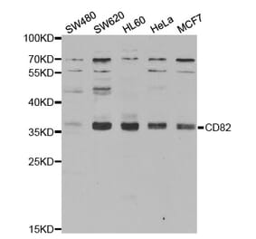 Western blot - CD82 Antibody from Signalway Antibody (32431) - Antibodies.com