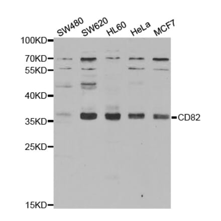 Western blot - CD82 Antibody from Signalway Antibody (32431) - Antibodies.com