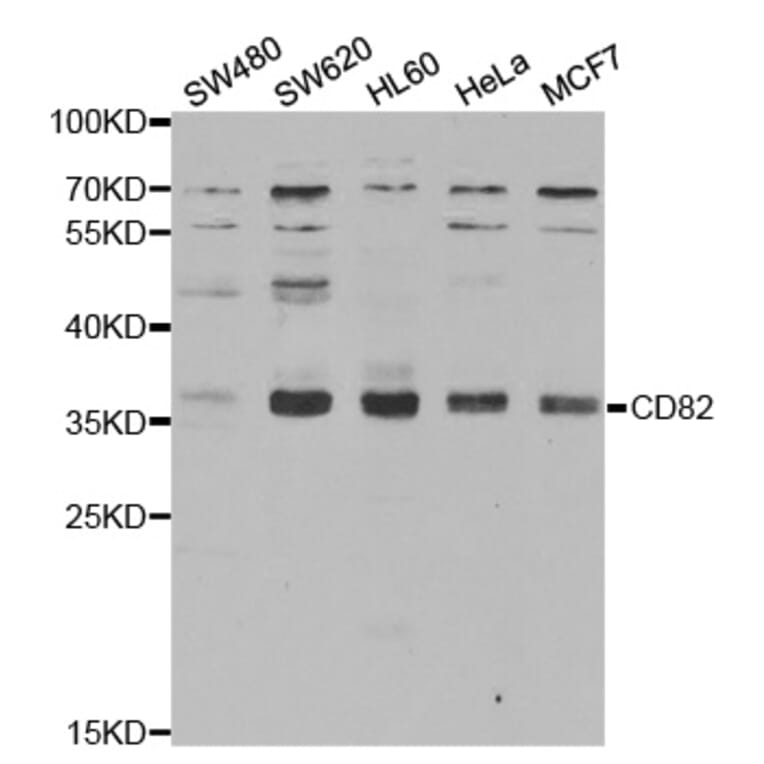 Western blot - CD82 Antibody from Signalway Antibody (32431) - Antibodies.com