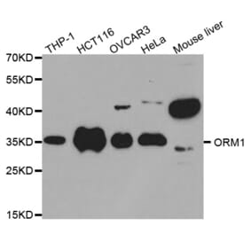 Western blot - ORM1 Antibody from Signalway Antibody (32439) - Antibodies.com