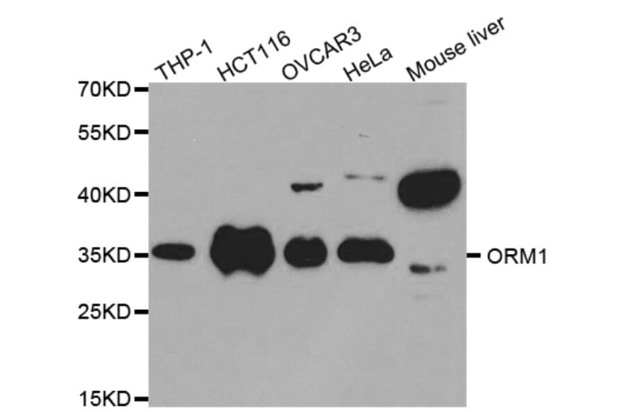 Western blot - ORM1 Antibody from Signalway Antibody (32439) - Antibodies.com