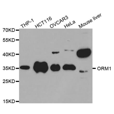 Western blot - ORM1 Antibody from Signalway Antibody (32439) - Antibodies.com