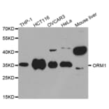 Western blot - ORM1 Antibody from Signalway Antibody (32439) - Antibodies.com