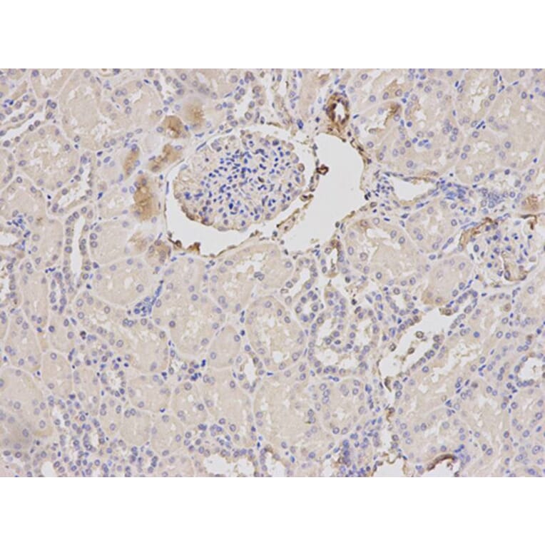 Immunohistochemistry - ORM1 Antibody from Signalway Antibody (32439) - Antibodies.com