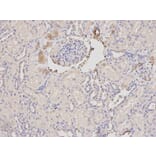 Immunohistochemistry - ORM1 Antibody from Signalway Antibody (32439) - Antibodies.com