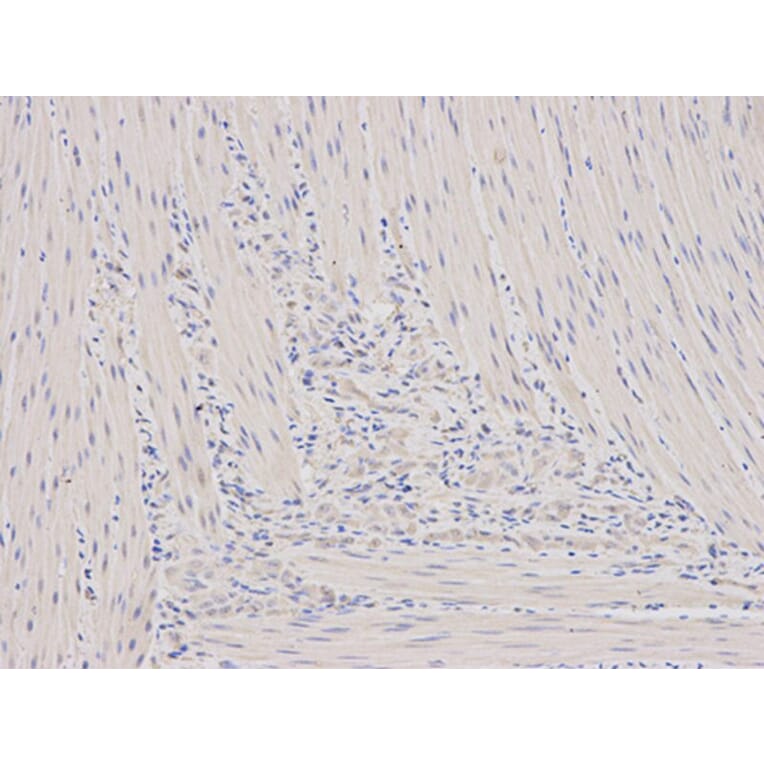 Immunohistochemistry - ORM1 Antibody from Signalway Antibody (32439) - Antibodies.com