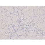 Immunohistochemistry - ORM1 Antibody from Signalway Antibody (32439) - Antibodies.com
