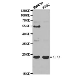 Western blot - KLK1 Antibody from Signalway Antibody (32443) - Antibodies.com
