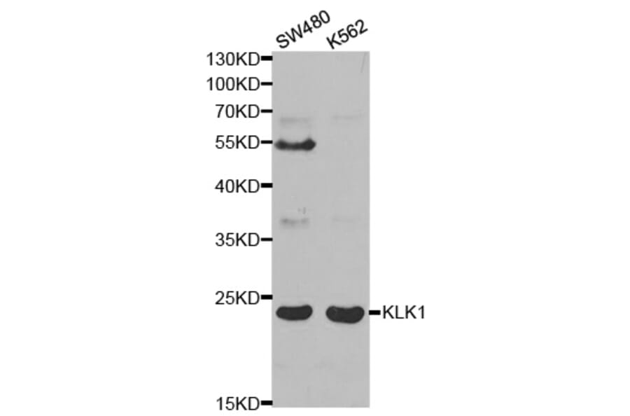 Western blot - KLK1 Antibody from Signalway Antibody (32443) - Antibodies.com