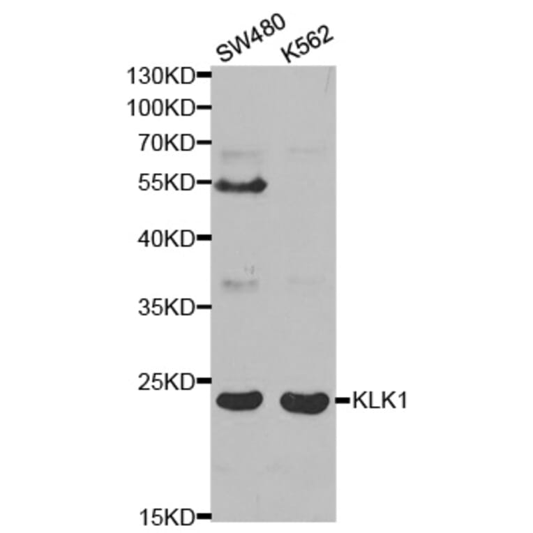 Western blot - KLK1 Antibody from Signalway Antibody (32443) - Antibodies.com