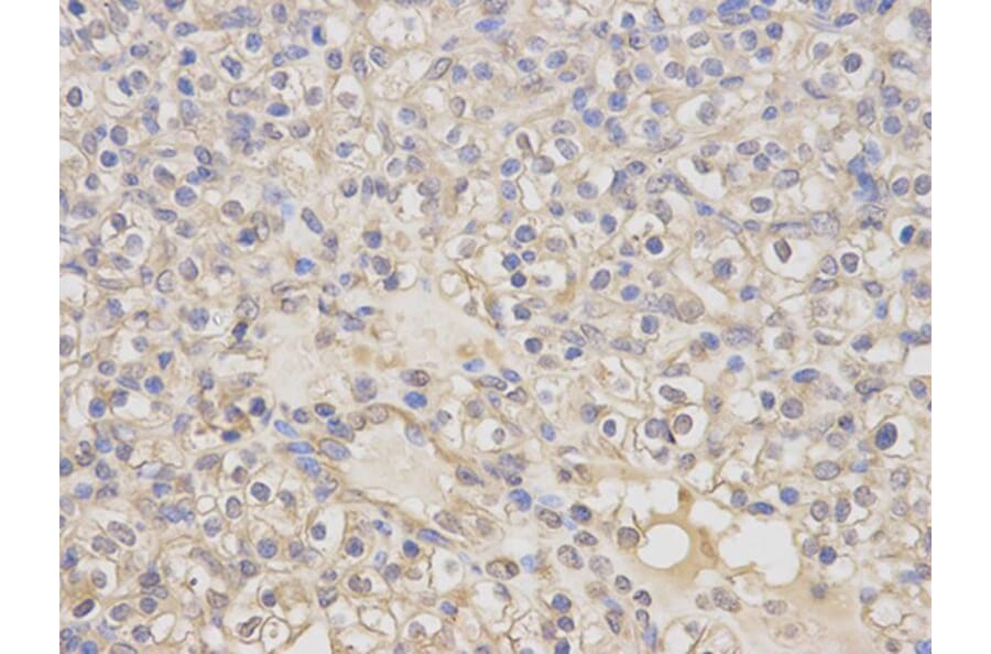 Immunohistochemistry - KLK1 Antibody from Signalway Antibody (32443) - Antibodies.com