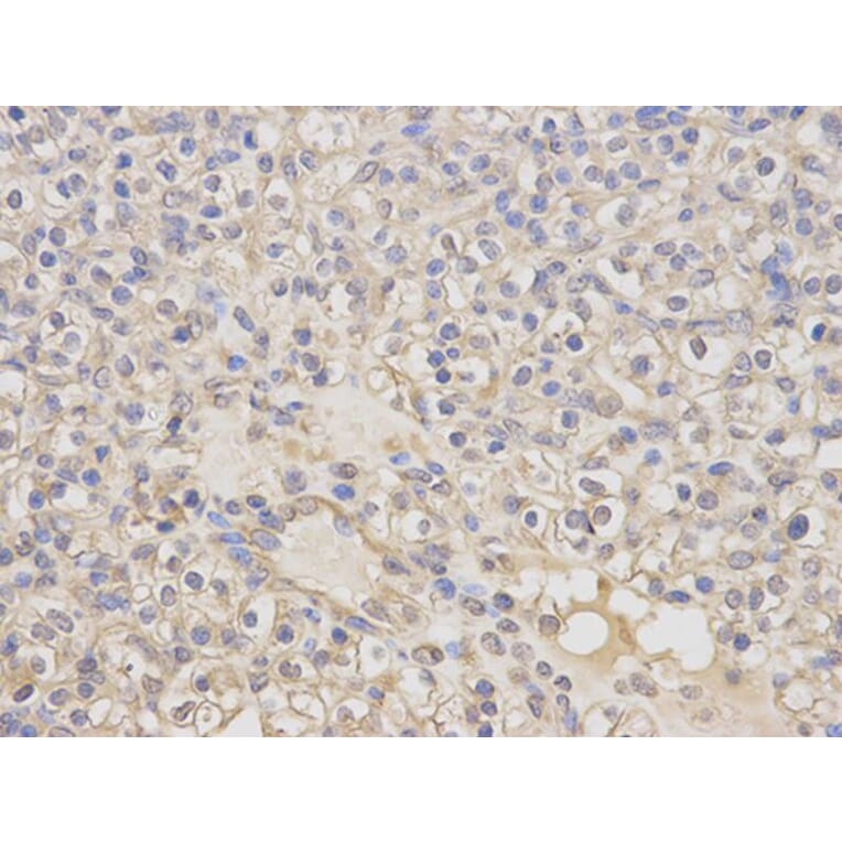 Immunohistochemistry - KLK1 Antibody from Signalway Antibody (32443) - Antibodies.com