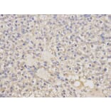 Immunohistochemistry - KLK1 Antibody from Signalway Antibody (32443) - Antibodies.com