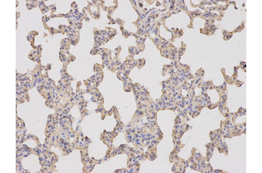 Immunohistochemistry - KLK1 Antibody from Signalway Antibody (32443) - Antibodies.com