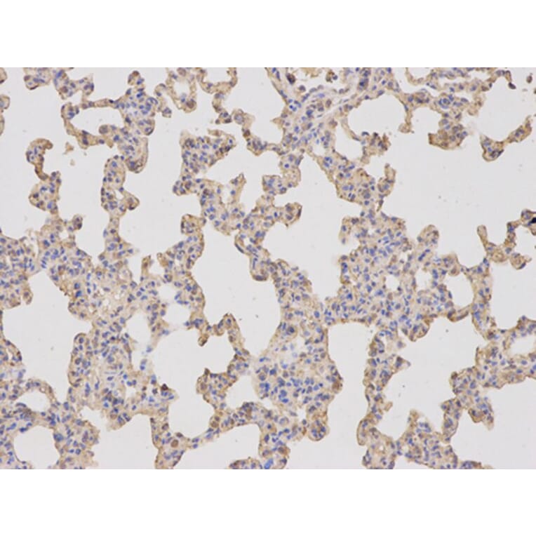 Immunohistochemistry - KLK1 Antibody from Signalway Antibody (32443) - Antibodies.com