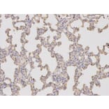 Immunohistochemistry - KLK1 Antibody from Signalway Antibody (32443) - Antibodies.com