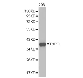 Western blot - THPO Antibody from Signalway Antibody (32453) - Antibodies.com