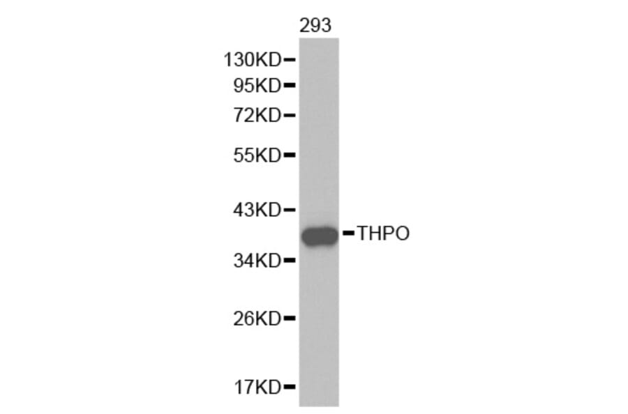 Western blot - THPO Antibody from Signalway Antibody (32453) - Antibodies.com