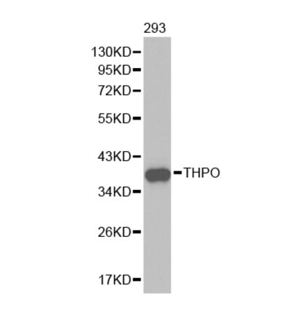 Western blot - THPO Antibody from Signalway Antibody (32453) - Antibodies.com