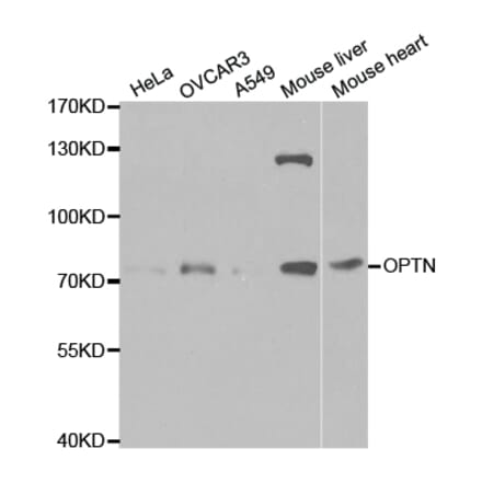 Western blot - OPTN Antibody from Signalway Antibody (32466) - Antibodies.com