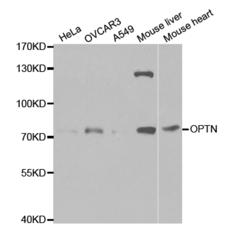 Western blot - OPTN Antibody from Signalway Antibody (32466) - Antibodies.com