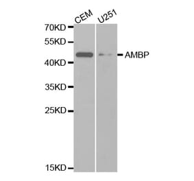 Western blot - AMBP Antibody from Signalway Antibody (32467) - Antibodies.com