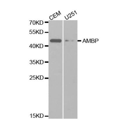 Western blot - AMBP Antibody from Signalway Antibody (32467) - Antibodies.com