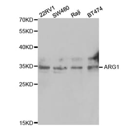 Western blot - ARG1 Antibody from Signalway Antibody (32468) - Antibodies.com