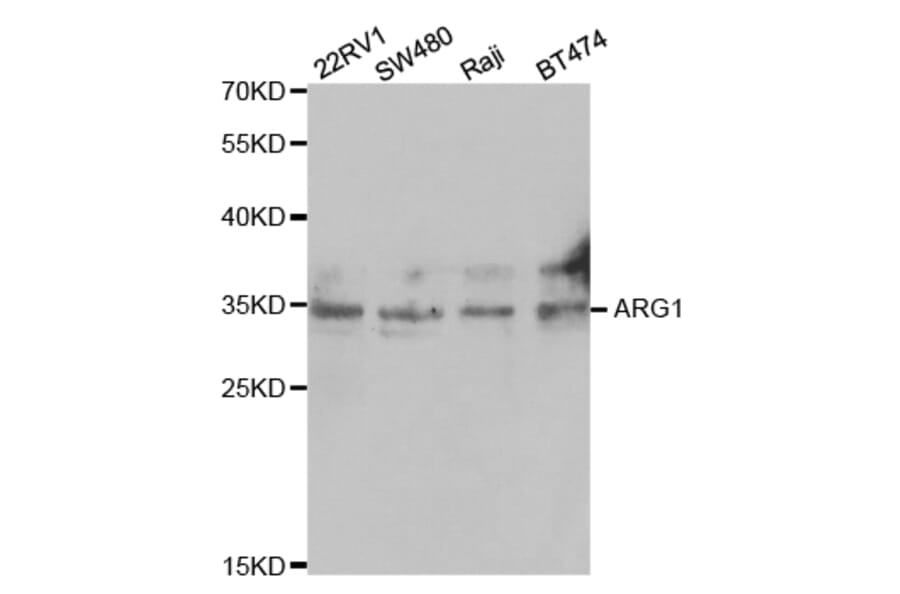 Western blot - ARG1 Antibody from Signalway Antibody (32468) - Antibodies.com