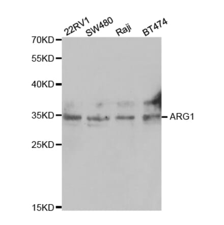 Western blot - ARG1 Antibody from Signalway Antibody (32468) - Antibodies.com