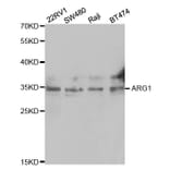 Western blot - ARG1 Antibody from Signalway Antibody (32468) - Antibodies.com