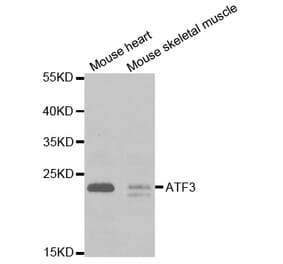 Western blot - ATF3 Antibody from Signalway Antibody (32471) - Antibodies.com