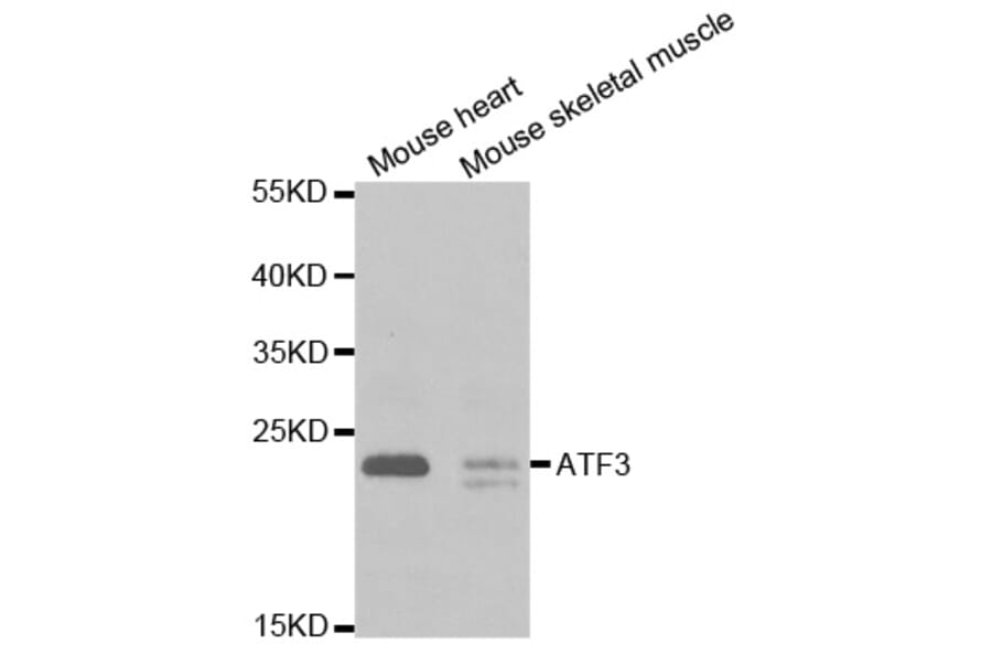 Western blot - ATF3 Antibody from Signalway Antibody (32471) - Antibodies.com