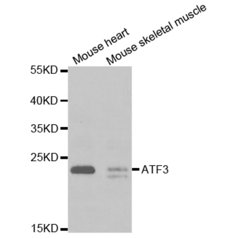 Western blot - ATF3 Antibody from Signalway Antibody (32471) - Antibodies.com