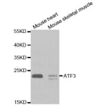 Western blot - ATF3 Antibody from Signalway Antibody (32471) - Antibodies.com