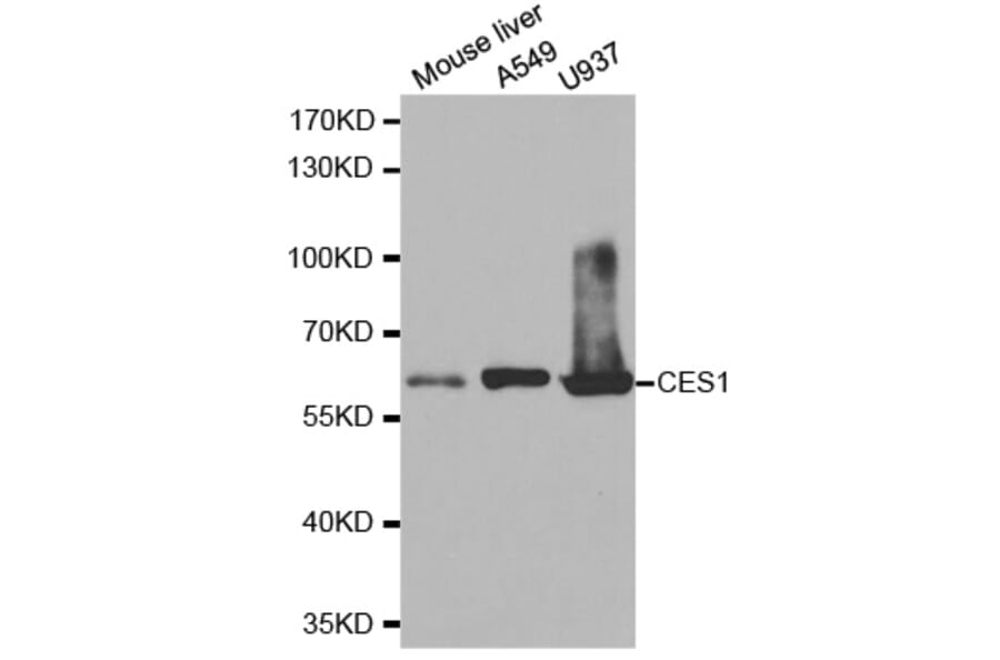 Western blot - CES1 Antibody from Signalway Antibody (32472) - Antibodies.com