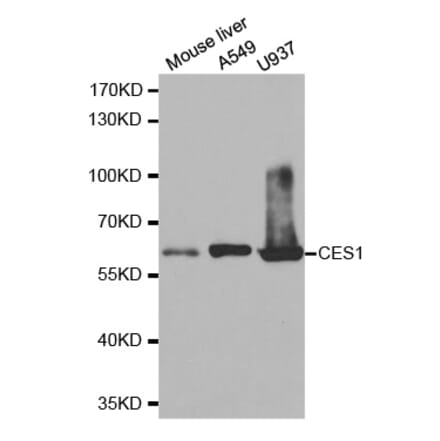 Western blot - CES1 Antibody from Signalway Antibody (32472) - Antibodies.com