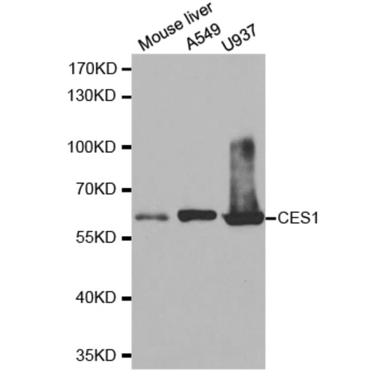 Western blot - CES1 Antibody from Signalway Antibody (32472) - Antibodies.com