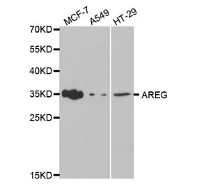 Western blot - AREG Antibody from Signalway Antibody (32476) - Antibodies.com