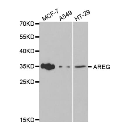 Western blot - AREG Antibody from Signalway Antibody (32476) - Antibodies.com