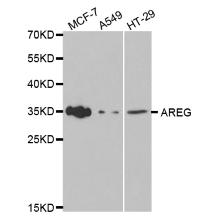 Western blot - AREG Antibody from Signalway Antibody (32476) - Antibodies.com