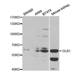 Western blot - GLB1 Antibody from Signalway Antibody (32478) - Antibodies.com