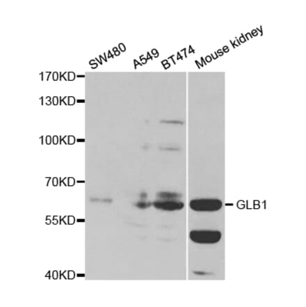 Western blot - GLB1 Antibody from Signalway Antibody (32478) - Antibodies.com