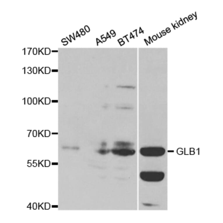 Western blot - GLB1 Antibody from Signalway Antibody (32478) - Antibodies.com