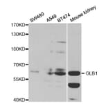 Western blot - GLB1 Antibody from Signalway Antibody (32478) - Antibodies.com