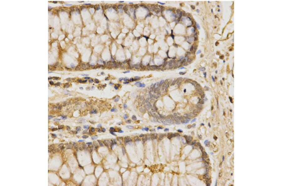 Immunohistochemistry - GLB1 Antibody from Signalway Antibody (32478) - Antibodies.com