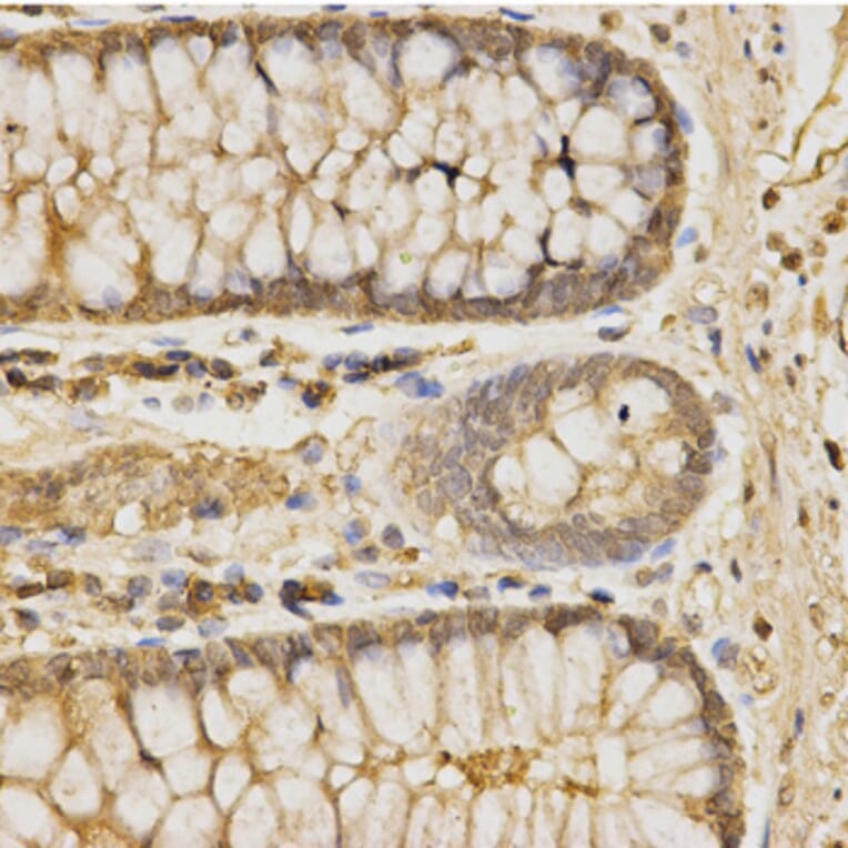 Immunohistochemistry - GLB1 Antibody from Signalway Antibody (32478) - Antibodies.com