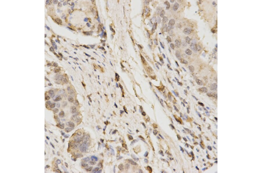 Immunohistochemistry - GLB1 Antibody from Signalway Antibody (32478) - Antibodies.com